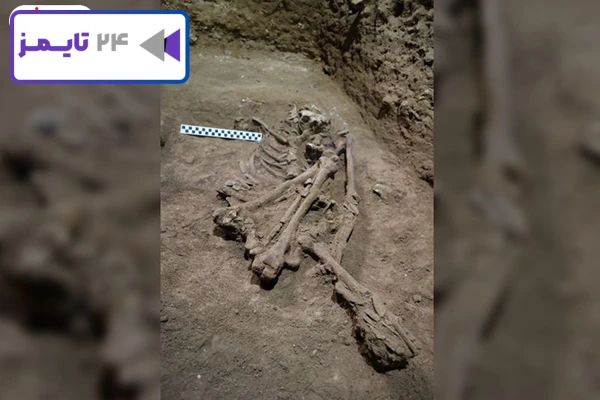 اسکلت ساق پای قطع شده