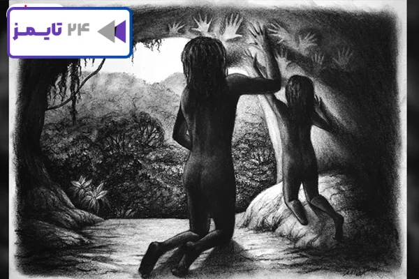 ساق پای قطع شده