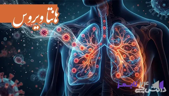 تحقیق در مورد هانتا ویروس | علایم و درمان