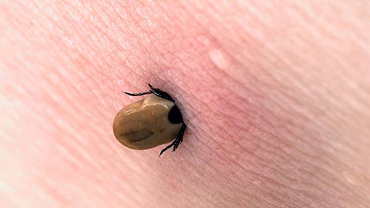 عکس کنه